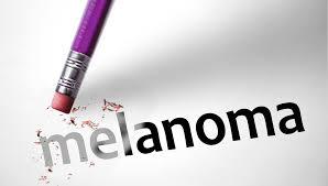 melanoma